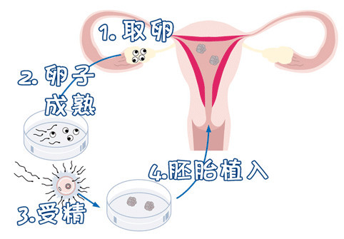 优胚鲜胚移植医学中心